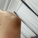 ［ 마포 / 홍대입구역 ] 여름맞이 필수! 팔꿈치미백 홍대 은뷰티 홍대점 바이뮬리 멜라닌케어
