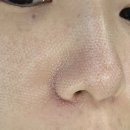 율스킨스토리