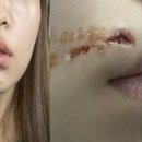 경기광주싱크대 이미지