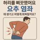 김경택한의원 | 🧘‍♂️ “허리를 삐끗했어요”요추 염좌, 왜 생기고 어떻게 회복할까요?