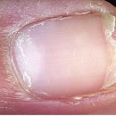 예쁜손톱 이미지