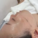 논현역 6번출구 뒤 | 논현역피부관리 은브로우앤뷰티 스킨플래닝 깐달걀피부 만든 후기