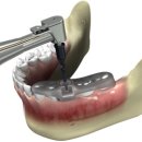 가이드치과기공소 이미지