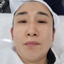 구월동 리프팅 프레야 리메플라윤곽관리 후기