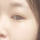 디어달