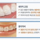 스마트치과의원 네이버블로그