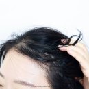 (주)영앤뉴 | 헤드앤숄더 쿨멘솔 비듬샴푸 추천 떡진머리 두피관리 후기
