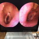 오티콘보청기 신촌센터 해피히어링 이미지