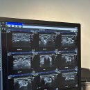 선유외과의원 | 제주 갑상선 초음파 갑상선기능저하의심 선유외과 비용 후기