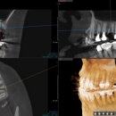 더드림치과기공소 이미지