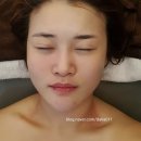 캔디피부관리실 네이버블로그
