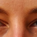 강남제일한의원 이미지