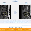 대구척추 관절치료, 대구참튼튼병원에서 건강히 지키세요 이미지