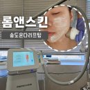 <롬앤네일>에서 송도온다리프팅 하고 온 후기! 통증❌️ 다운타임❌️ 즉각효과🙆‍♀️