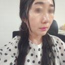 홍대 피부과 심부볼 팔자주름 실리프팅 후기와 관리 놀라움의힐링