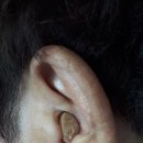 회르만보청기 | 청주 보청기 :: 회르만보청기 청주점, 타 매장과 비교 리뷰