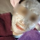 열매한의원 | 홍대 한의원 스킨부스터 새살화침 후기