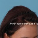 제이제이서연외과의원 네이버블로그