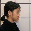 궁금한 키, 궁금한 사춘기 | 주걱턱 어린이치아교정, 부모가 가장 많이 후회하는 순간은?