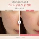 부자가가 | "샬랑 드 파리 빙하수모공축소앰플" 민감성 모공부자가 써본 솔직후기