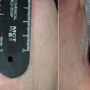 재생플란트치과의원 이미지