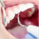 서울나란이치과의원 이미지