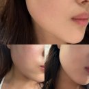 광주 북구 피부관리 에이치앤에이치더바디 착붙팅 제대로네