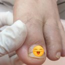 레푸스 구로점 이미지