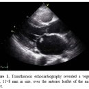 간 이식 환자에서 발생한 아스페르길루스 심내막염 1예 이미지
