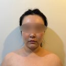 수원피부관리 쁨뷰티 선이고운얼굴 실루엣케어 만족후기