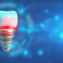 고려치과기공소 이미지