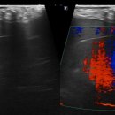 청진약품 | [강아지 담낭 수술 후기] 수술 후 8개월차 ｜간수치, 결석, 갑상선기능저하증 의심까지