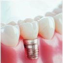 연세365감동치과의원 | 폐경기 여성의 구강 건강 호르몬 변화와 관리 방법