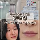 최치과의원 | 신사역피부과추천 올핏의원 쥬베룩 볼륨, 보톡스 시술후기