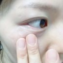 눈주름 아이크림 발라 없애기