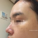 루비에스테틱 - 해운대구 재송동 | 깨순이의 루비레이저 리팟레이저 후기 와 후회