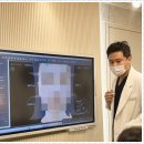 울타늄 팔자주름, 이중턱 로렐의원에서 효과 본 후기