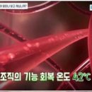 고주파 리페어 이미지
