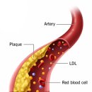 피트니스 에이치 이미지