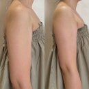 양덕동301 | 마산피부관리 웨딩관리 추천 팔뚝슬리밍관리 로에르에스테틱 후기