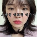 의료근린공원 | 대구 시지피부과 스마일리프팅 리쥬엘 후기