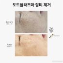 더스무스스킨케어&왁싱 네이버블로그