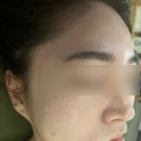 북면423 | [창원피부]북면에스테틱,창원웨딩관리,에스테틱치유,전문에테틱창원,데콜테맛집,창원피부관리추천