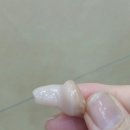 참좋은보청기 이미지