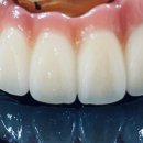 바라던 치과기공소 이미지