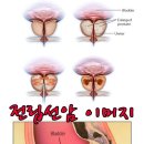 환자맞춤형 치료로 전립선암 정복에 도전하다 전립선암명의/삼성서울병원비뇨기과 이현무교수 이미지