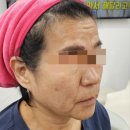 핫톡스힐링센터 | 대림역 마사지 피부관리는 역시 산새그린힐링센터!