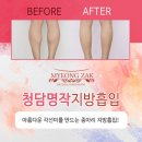 바디명작 이미지