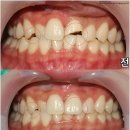 세라믹치과기공소 이미지