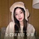 이에스의원 | 눈썹하거상술 비용 흉터 후기 알려드립니다